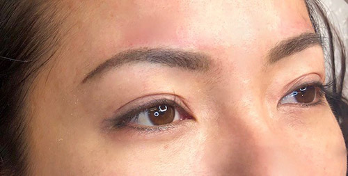 Microblading Removal in Los Angeles