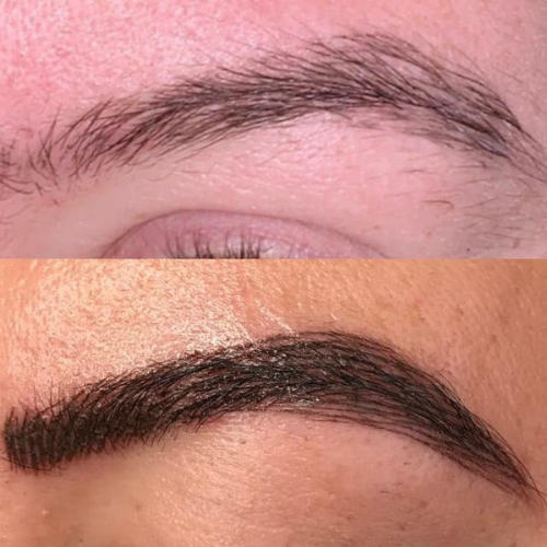 saline microblading removal near me in Los Angeles