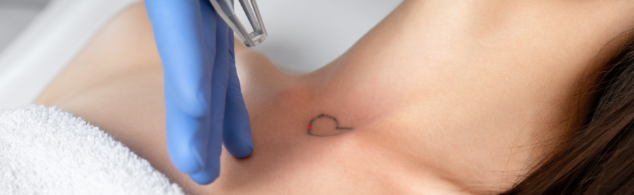 PSA You Could Be Pooping Out Your Tattoo When You Get It Removed